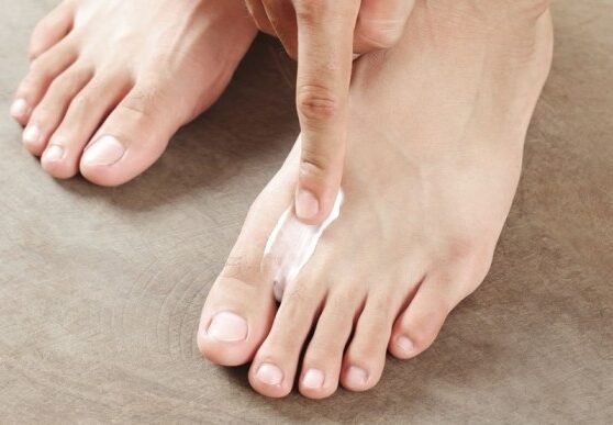 Best athletes foot cream