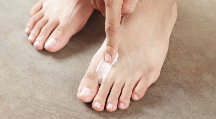 Best athletes foot cream