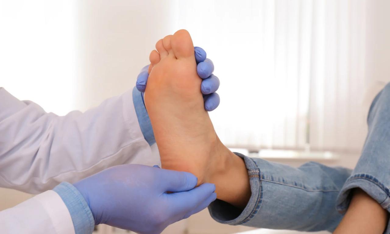 Best athletes foot treatment reddit